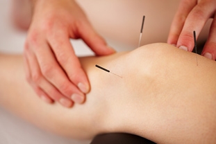 Experiencing Pain? Try Acupuncture