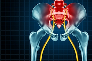 Sciatica: Causes, Symptoms, and Treatments