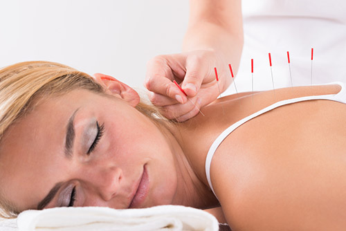 Acupuncture  Benefits - Helping  Post - Surgery Recovery