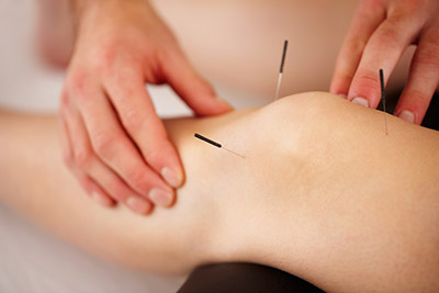 Find Healing in the New Year Through Acupuncture