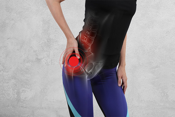 When Should I Consider a Hip Replacement?