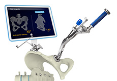 Computer Assisted Total Knee Replacement